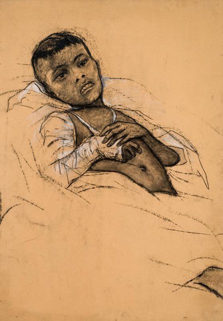 Госпиталь в провинции Тхань Хоа. Мальчик, раненный шариковой бомбой. 1967. Глазунов И.С.